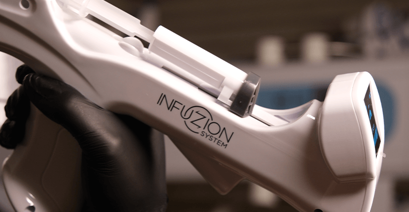 Infuzion System